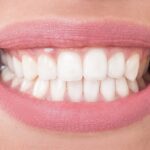 Co zrobić żeby mieć białe zęby